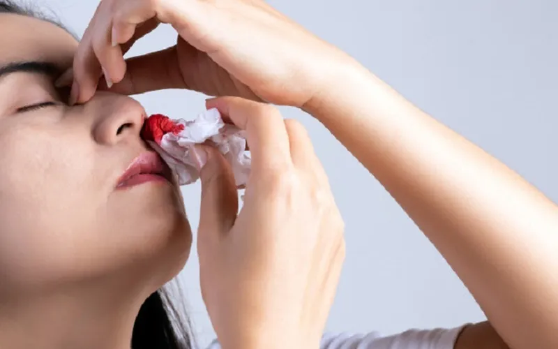 Nằm mơ thấy bị chảy máu mũi